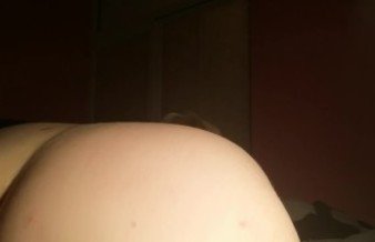 Fart after anal sex and push sperm out my ass, prolapse